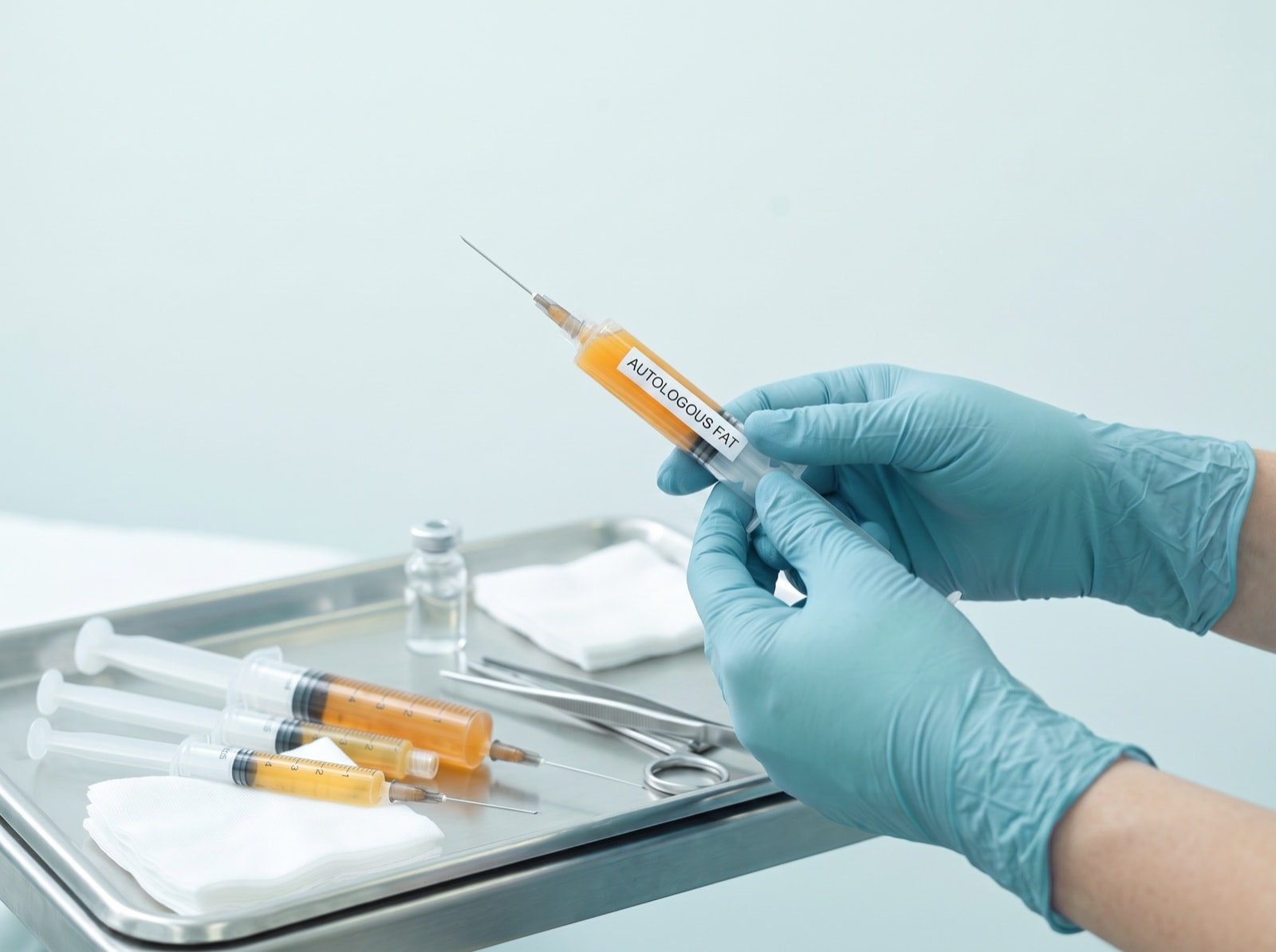 Technik des Fett-Transfers (Lipofilling)