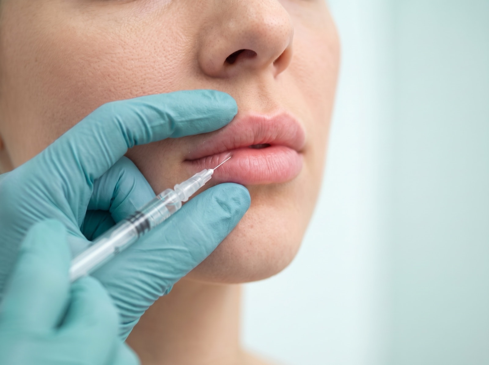 Vorteile der Lippenvergrößerung mit Hyaluronsäure