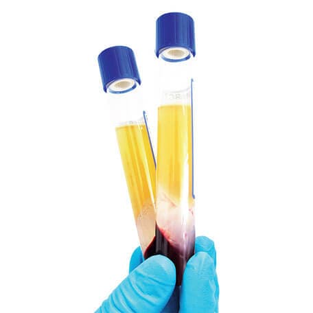 Mesotherapie (Mesolifting) – Eigenbluttherapie mit PRP