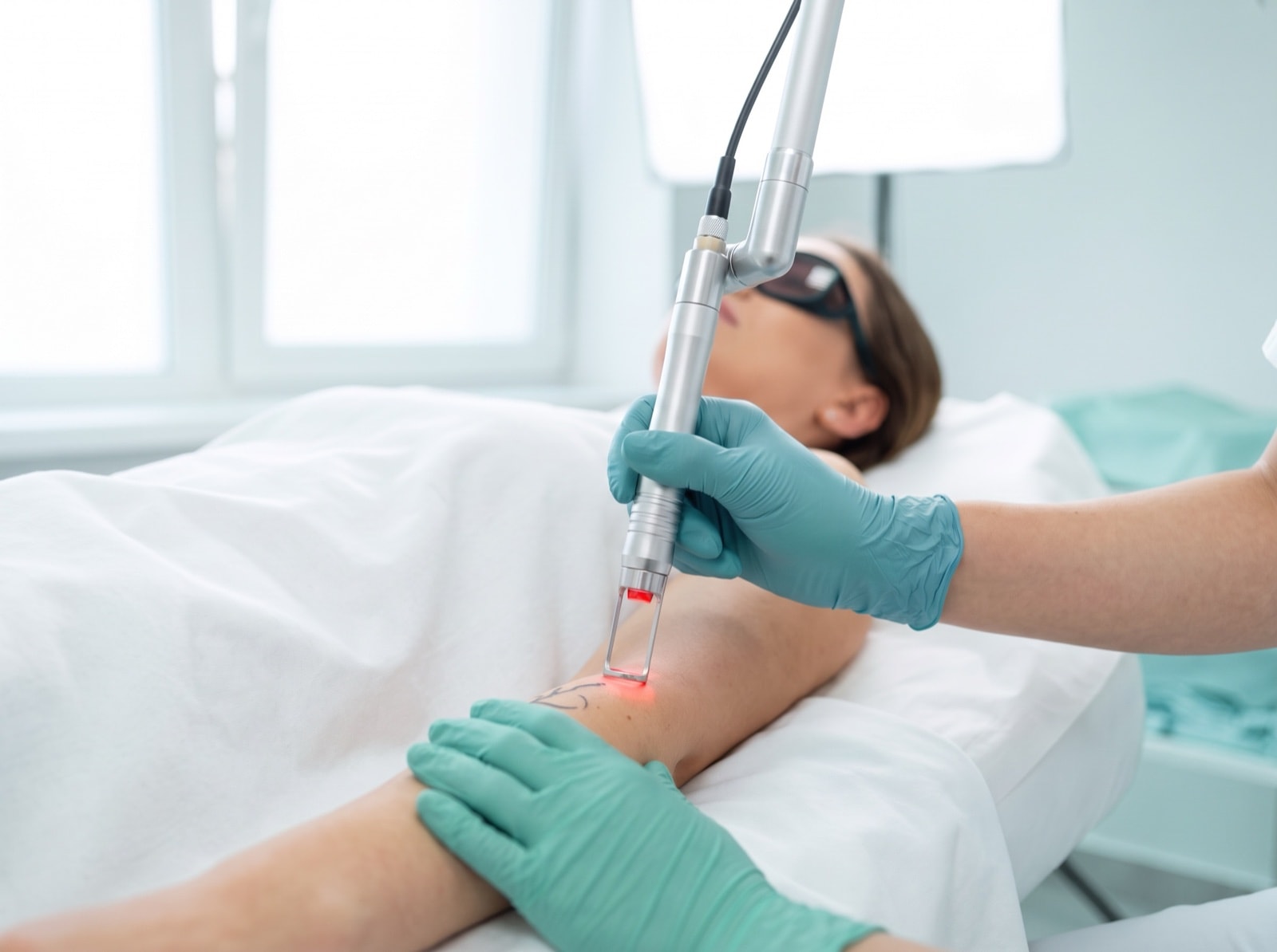 Tattooentfernung mit dem Pico-Laser in Dresden