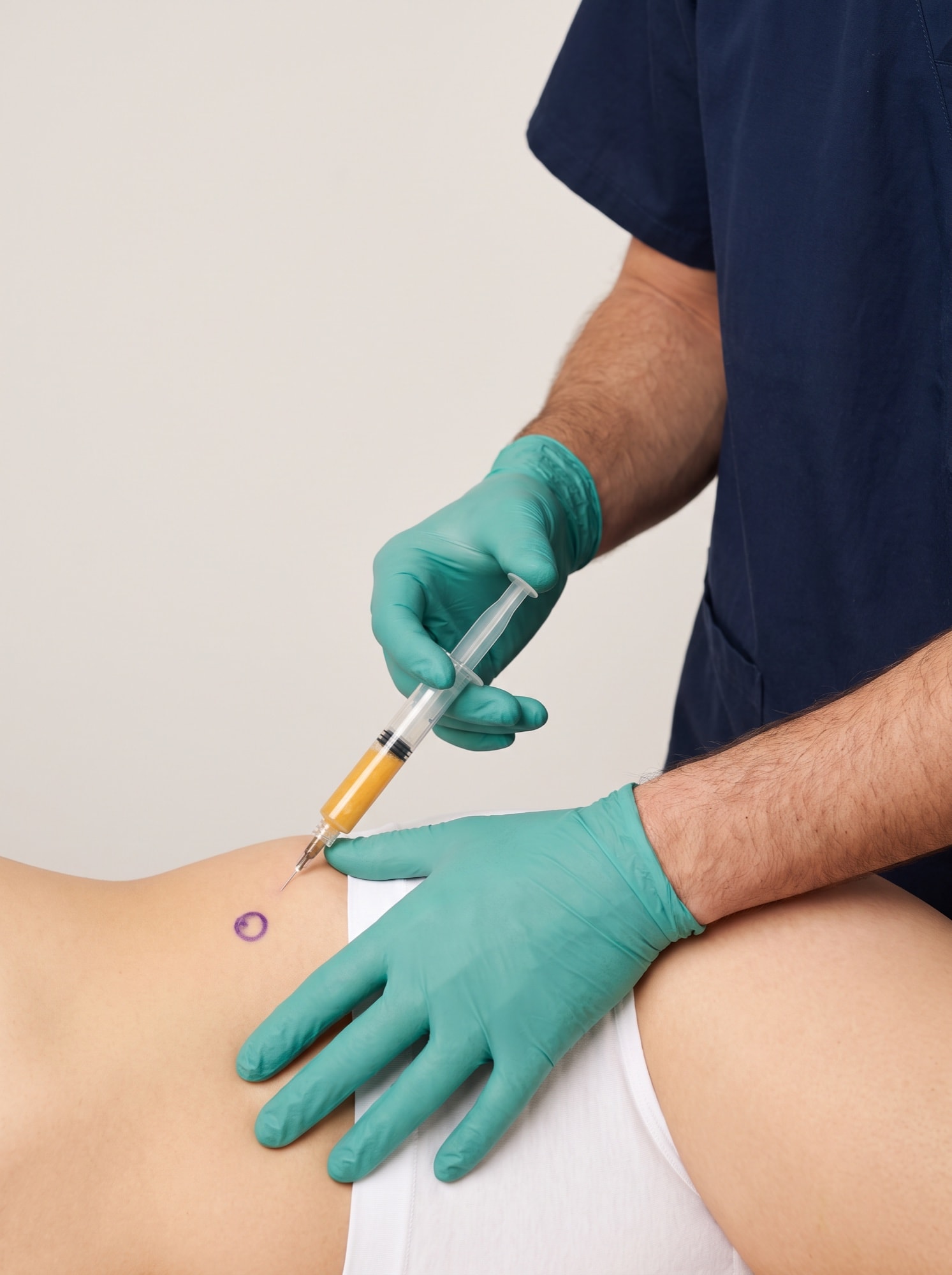 Lipofilling