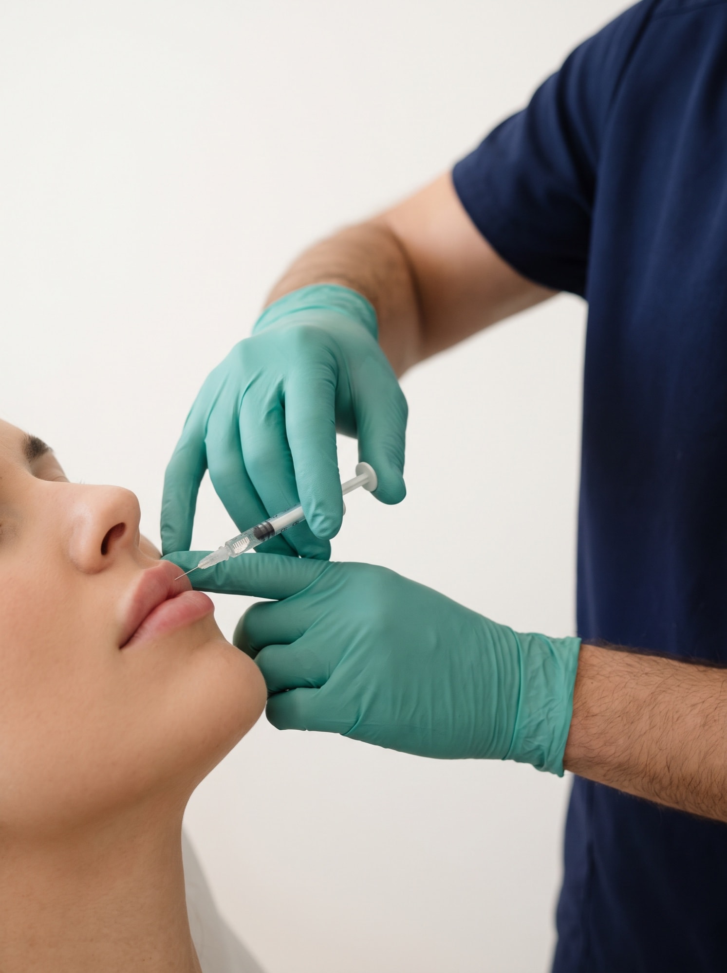 Lippenvergrößerung / Lippenunterspritzung mit Hyaluronsäure in Dresden