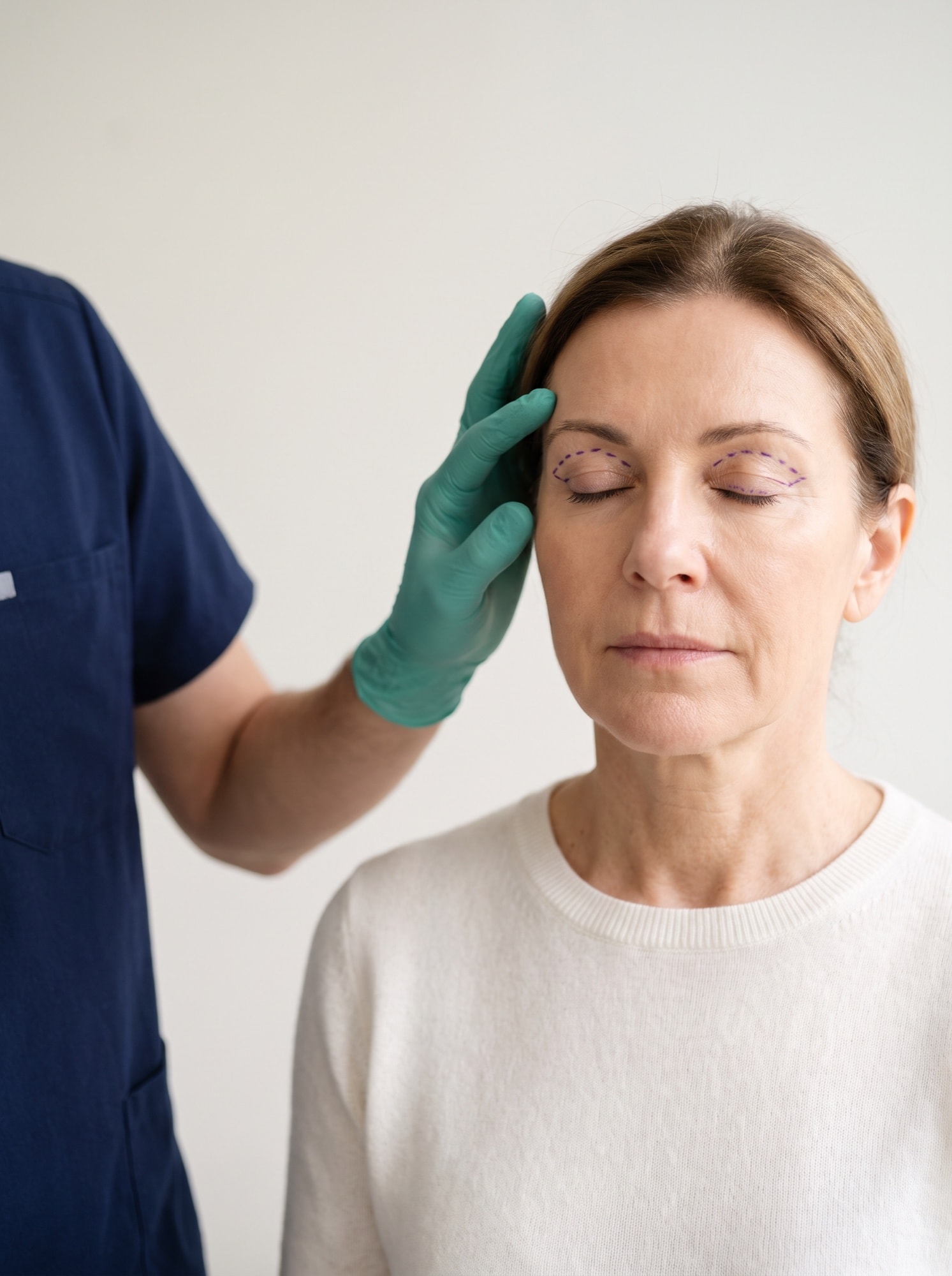 Oberlidstraffung (Blepharoplastik)